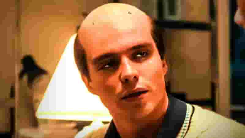 Why Did Lyle Menendez Have Screws on His Head In Monsters Netflix?