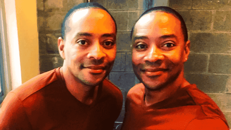 Meet Chicago Med's Conjoined Twins In Real Life: Jason & Victor Turner Biography Details